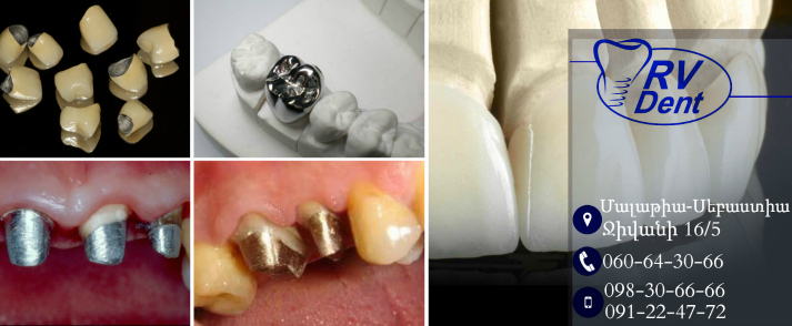 IPS-EMAX-HEADER-IMAGE