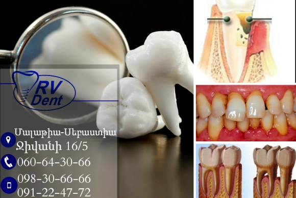 dis cekimi azi disleri fotograf555555555555555555