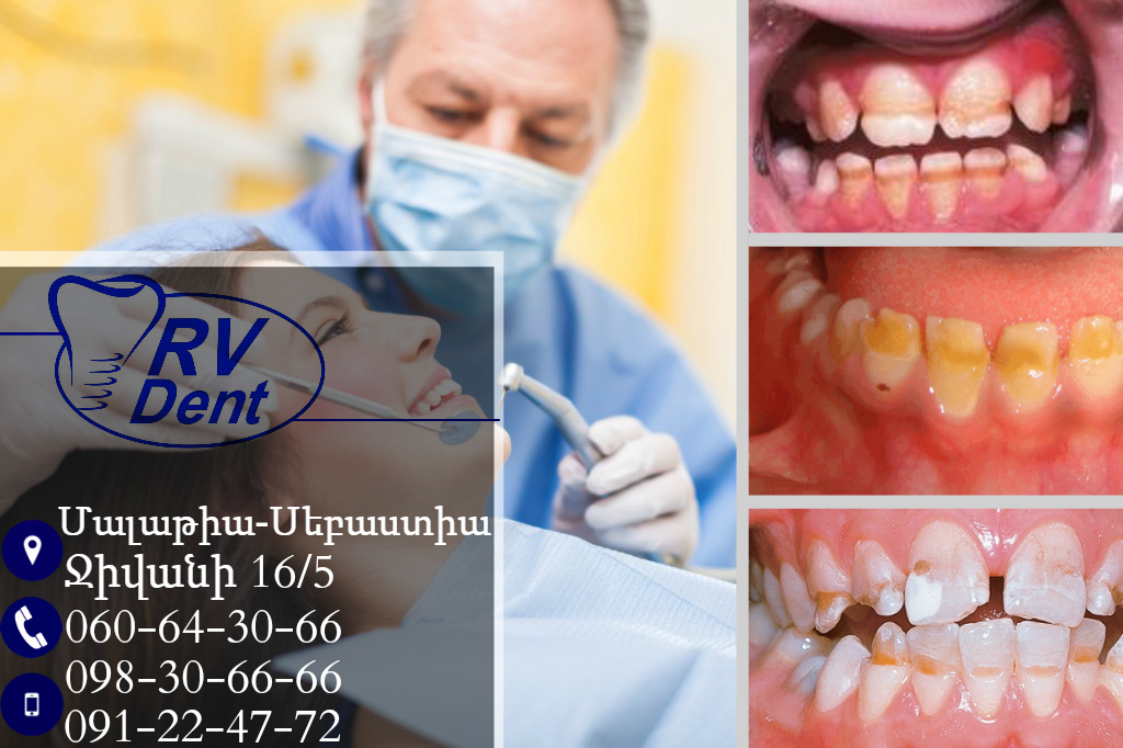 good dentist cleaning 1024x682