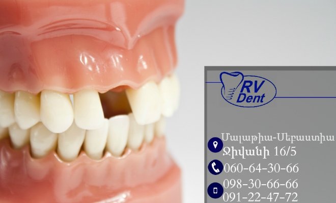 jjjjjjjjjjjjjjjjjjjjjjj