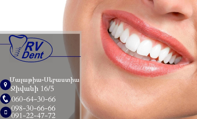 obloshki himnakan55555555555